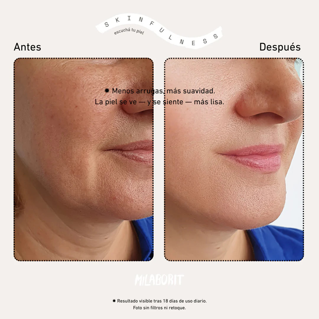 Kit Firmeza + Hidratación Profunda - Tipo Botox